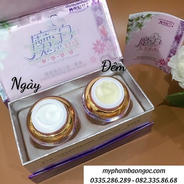 bộ kem hoàng cung 2in1 trị nám